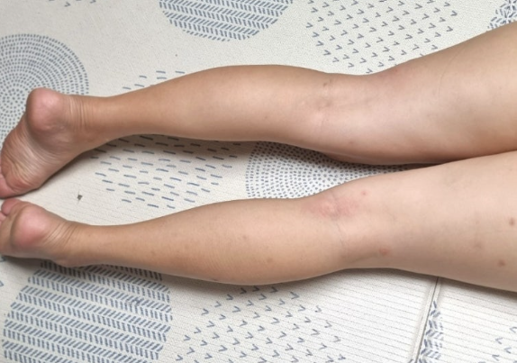 레그필 내돈내산 효과