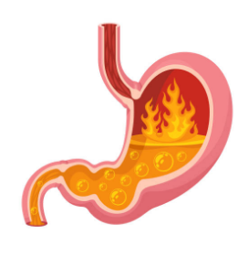 역류성 식도염에 좋은 음식, 증상, 자연치료 방법 총정리 (2024ver)