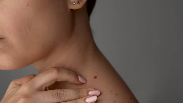 왜 쥐젖이 생길까? 쥐젖 원인부터 제거 방법까지 한눈에 보기!