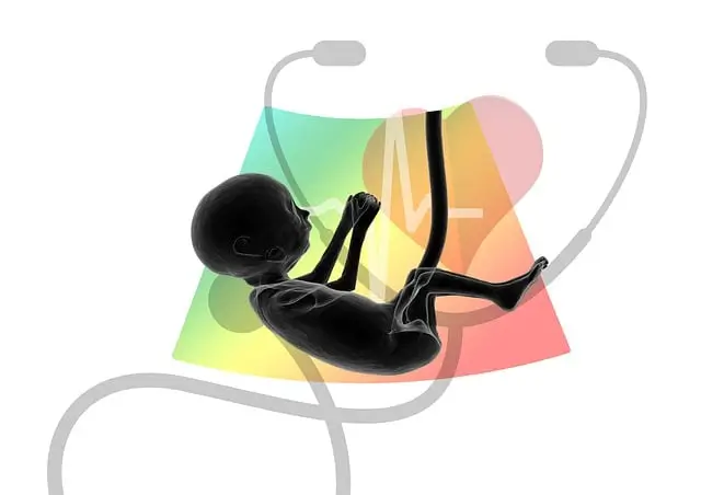 ultrasound-4536367_640