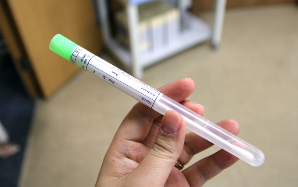 보건증 발급검사2