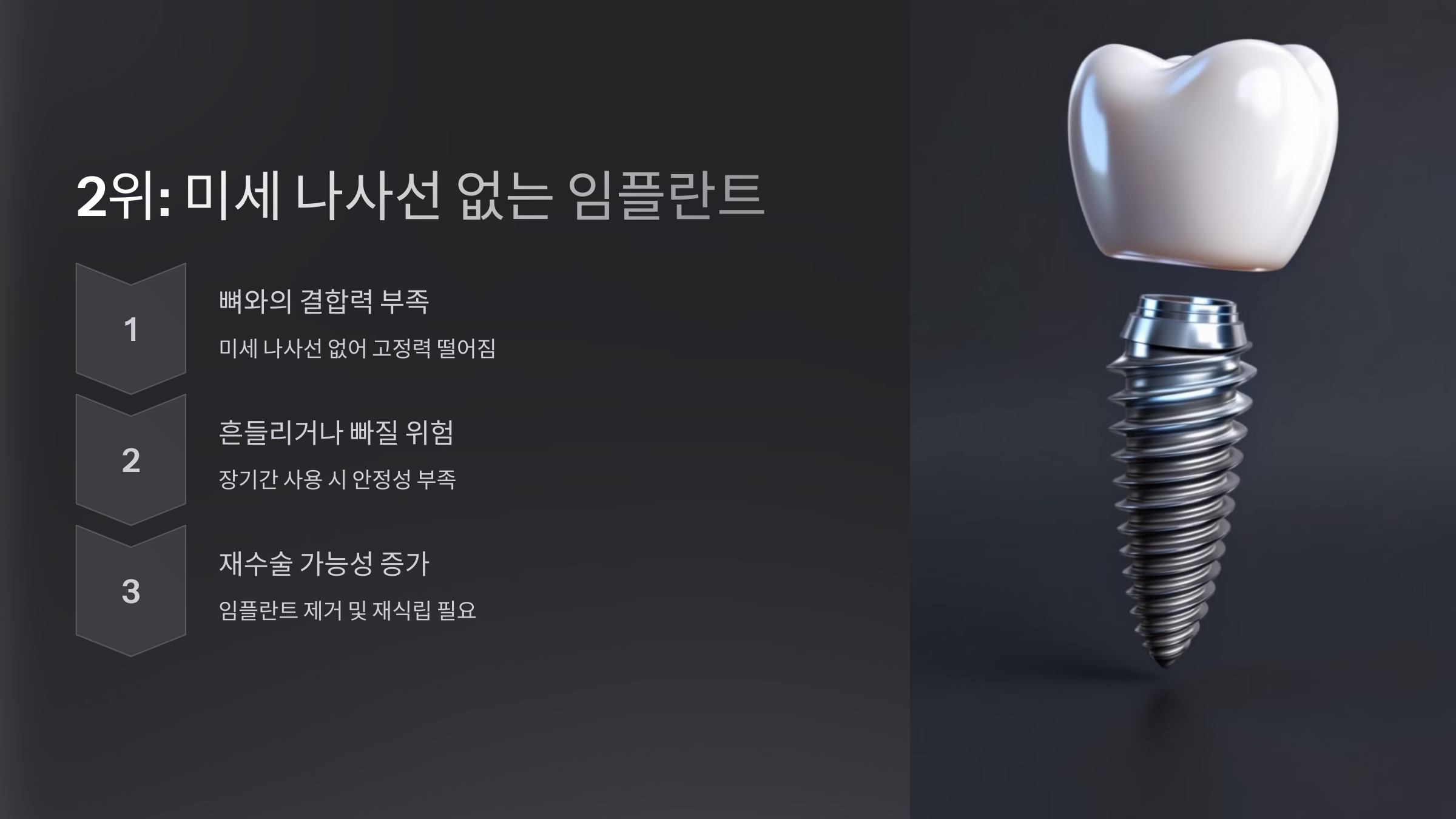 2위: 미세 나사선 없는 임플란트