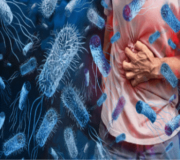 비브리오패혈증 증상