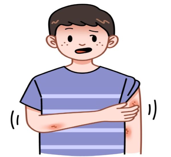 피부에 염증이 생긴 남자아이