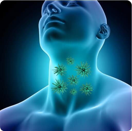 갑상선 기능 항진증에 대해 설명하는 그림