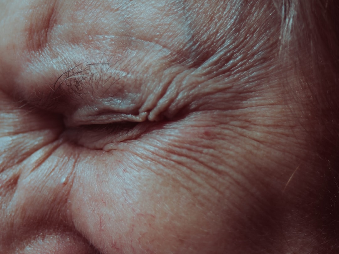Anti-aging