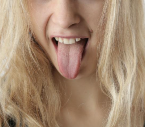 혀에 생긴 설태