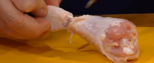 다리힘줄-제거-이미지