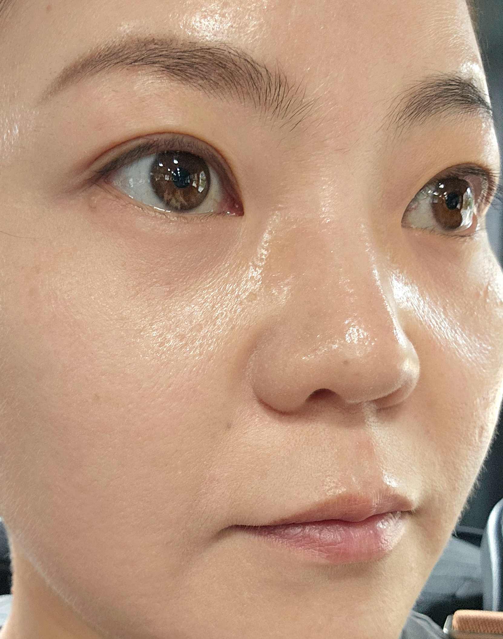 세포랩 사용 후 1달 지났을 때 피부 변화