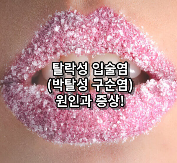 탈락성 입술염(박탈성 구순염)원인과 증상