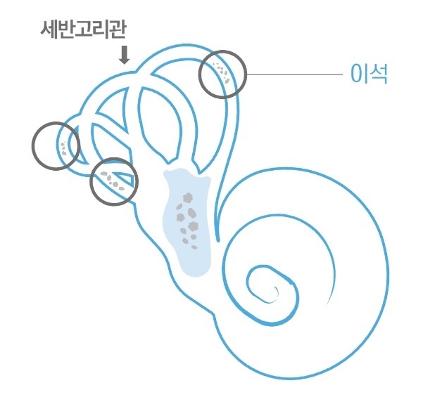 어지럼증명의-변재용-교수