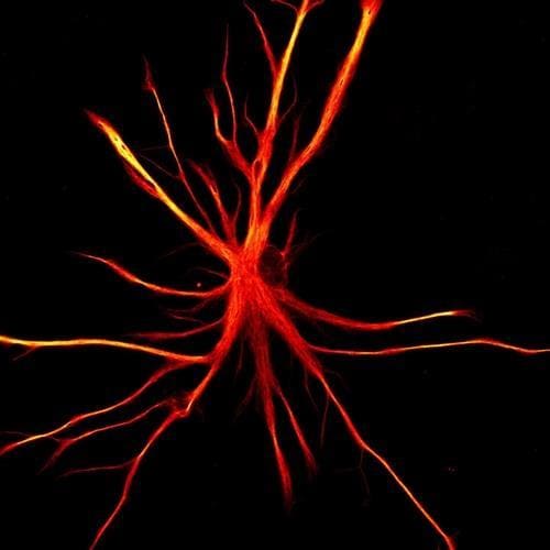 노년기 규칙적 운동이 인지 기능 저하를 막는 메커니즘 Exercise Alters Brain Chemistry to Protect Aging Synapses