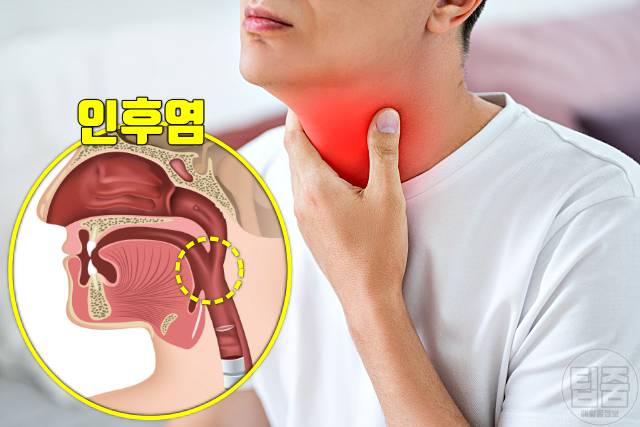 목감기에 좋은 차 목감기 빨리 낫는법