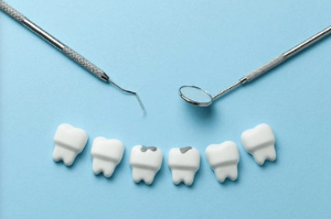 치아 틈새에 있는 검은 점은 충치