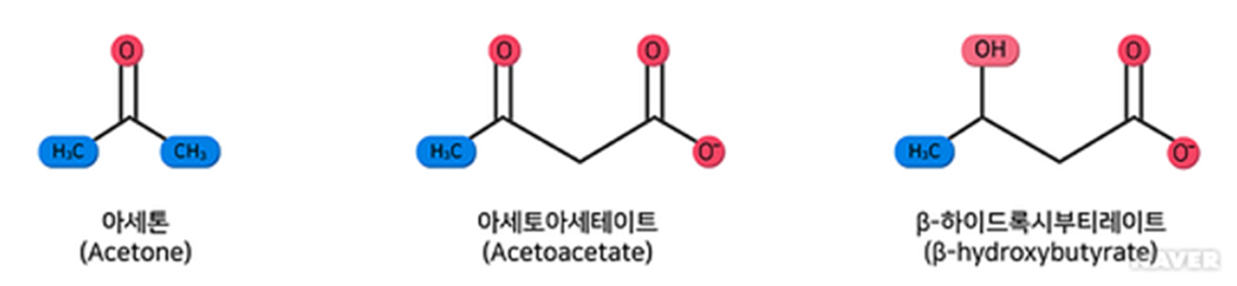 케톤체