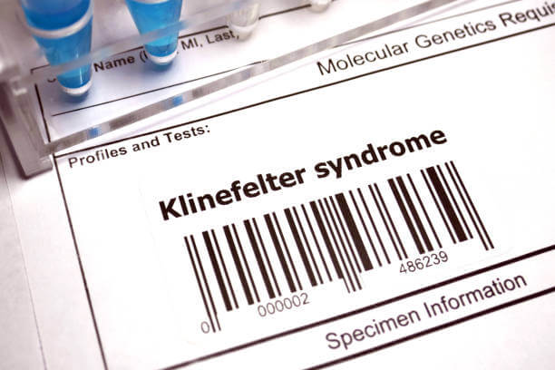 클라인펠터 증후군, 남자가 유방이 나온다면? 대표적인 증상입니다. 클라인펠터 증상은 다양하게 더 있습니다. 어떤 증상과 원인 그리고 진단과 치료에 대해 알아봤습니다. 참고하시기 바랍니다.
