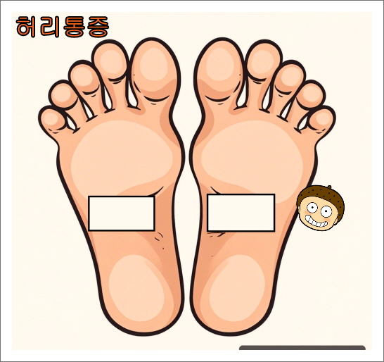 발바닥 파스 붙이는 위치_허리통증