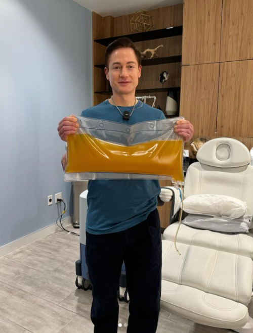 자신의 혈장을 들고 있는 브라이언 존슨