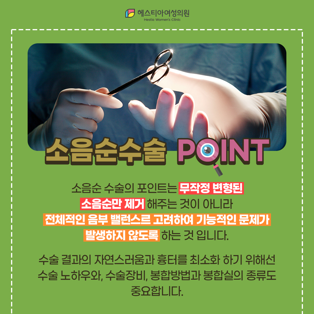 소음순수술 포인트