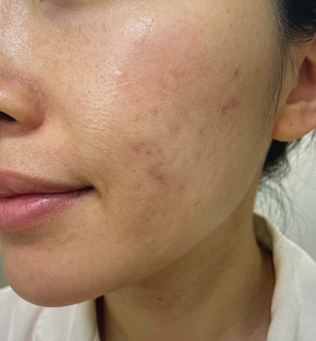 셀라딕스 131 앰플 후기 인증하기 위한 셀카사진