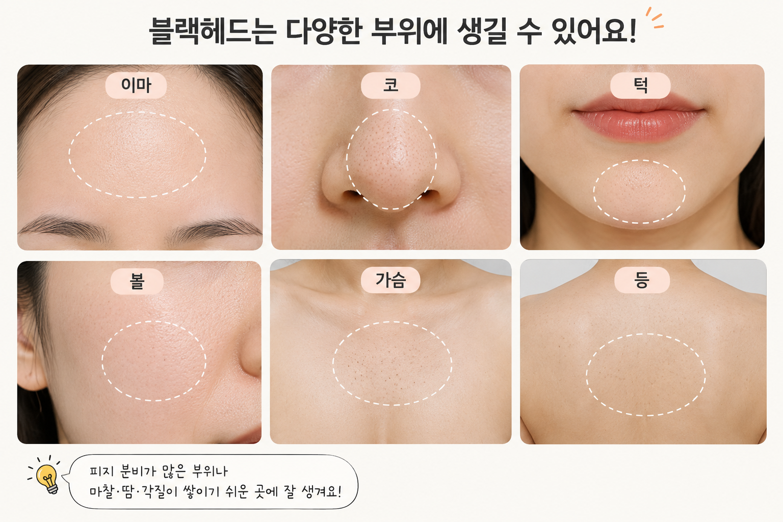 순한 클렌저와 보습제, 자외선 차단제와 깨끗한 수건으로 T존을 관리하는 장면