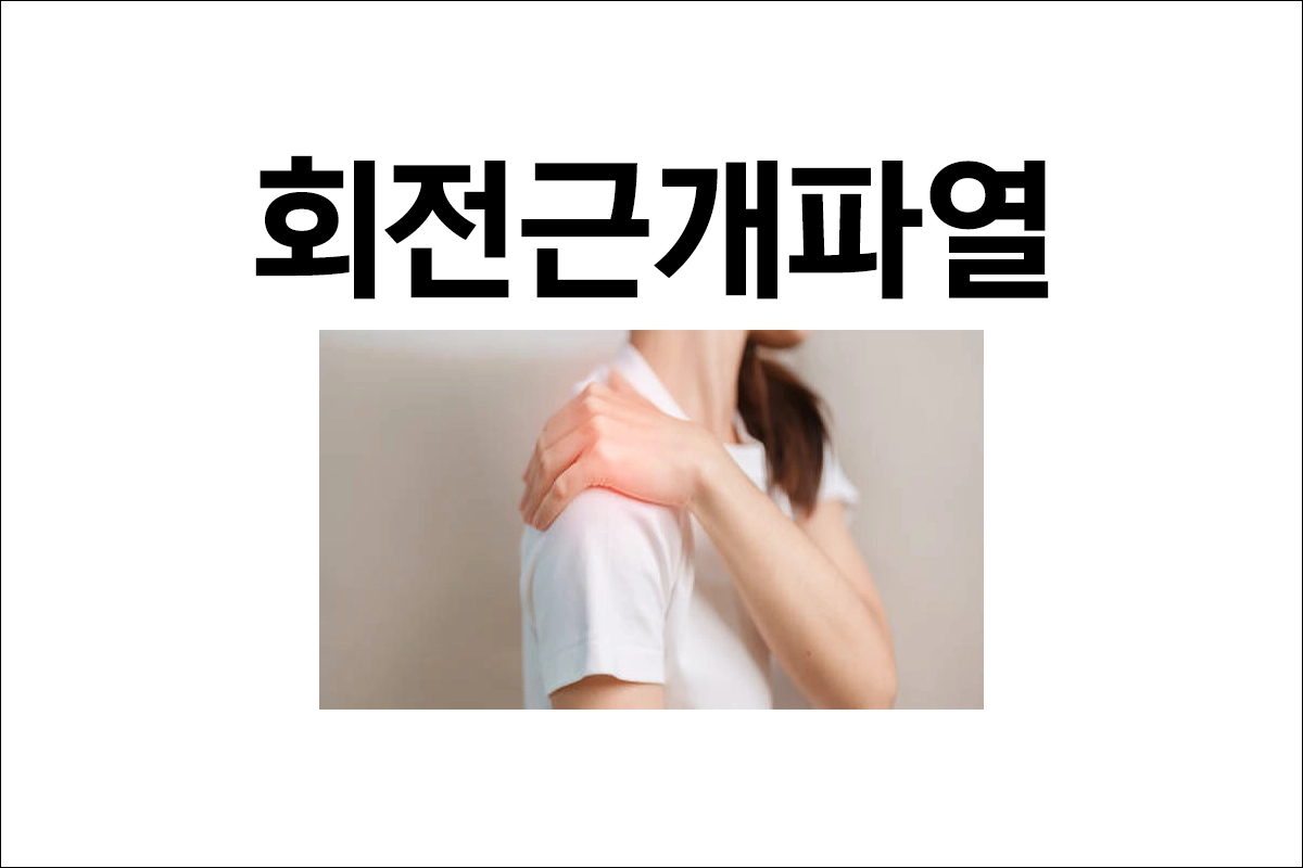 회전근개파열 치료 수술 후 회복 관리