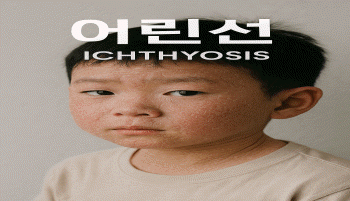 어린선