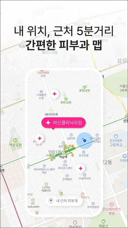 여신티켓, 피부과 정보, 피부과 전문의 모바일 상담 서비스