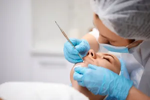 블랙-헤드-제거