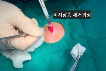 남자 얼굴 피지 제거 화장품 꿀템_3