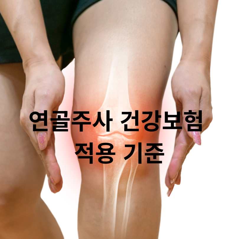 무릎연골주사 건강보험 적용 기준과 혜택