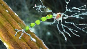 루게릭병증상 및 치료 