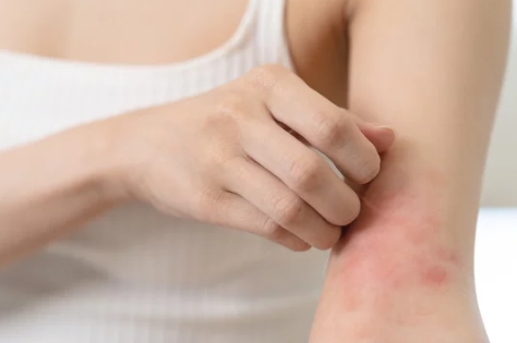 글루타치온부작용