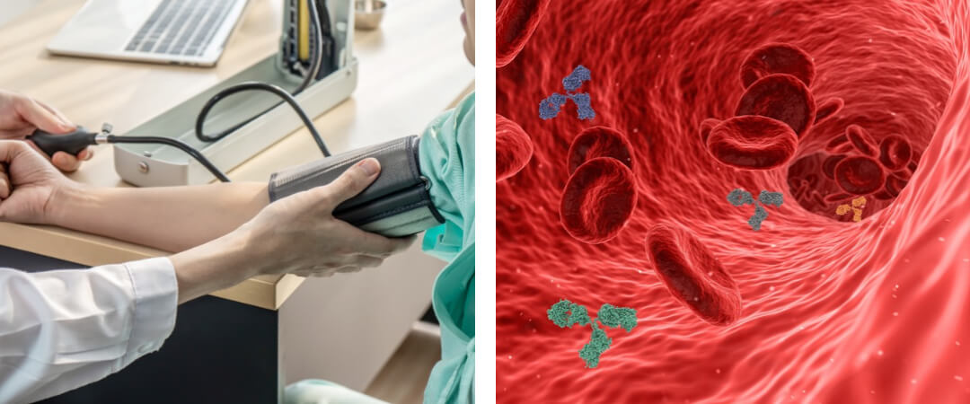 혈압을 측정하는 사진과 혈관속 혈액 흘러가는 사진