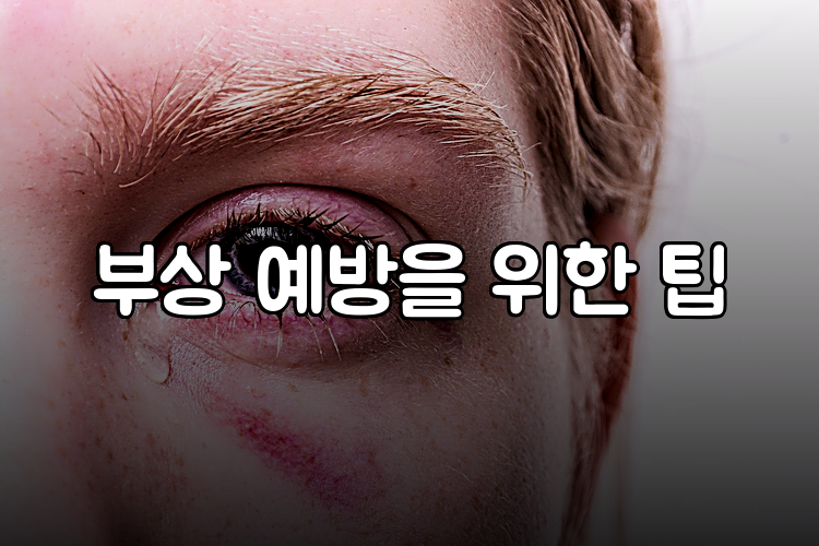 부상 예방을 위한 팁