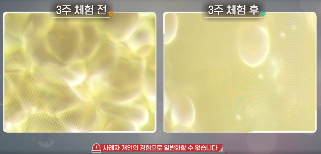 폴리코사놀 효능