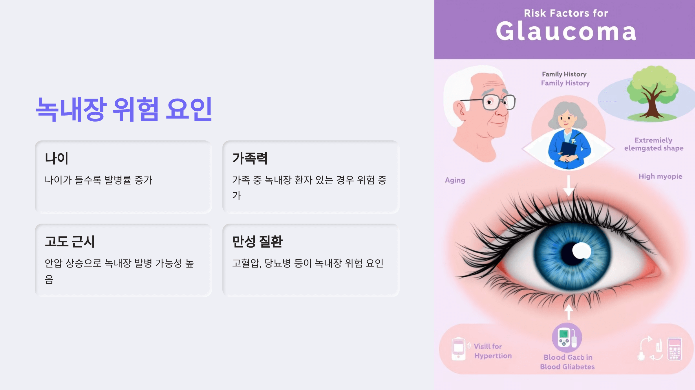 녹내장과 관련된 사진입니다.