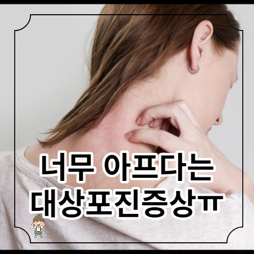 대상포진 감염