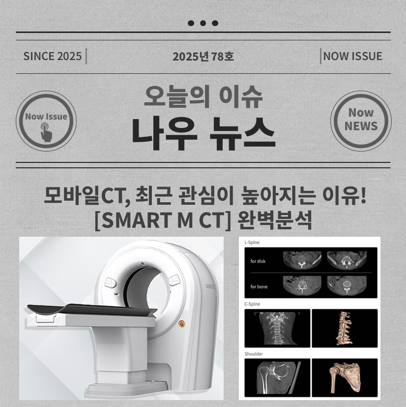 모바일 CT 대표사진