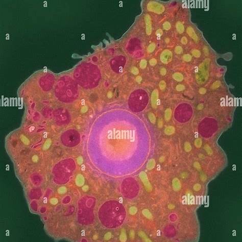 뇌 먹는 아메바 관련 사진