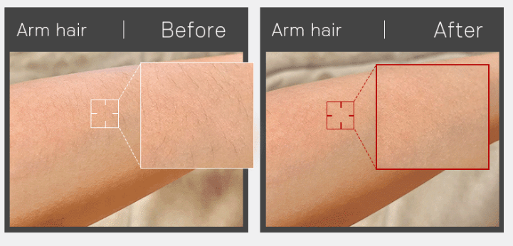 뷰앤디 눈썹 잔털 지우개