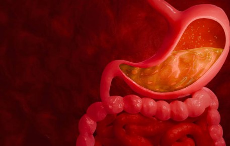 위·장 건강 이슈 (헬리코박터, 역류성식도염, 장염)