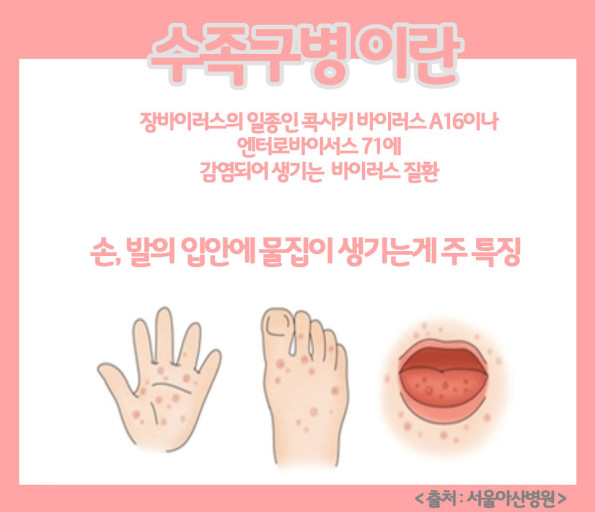 수족구병: 원인, 증상, 예방 및 관리 방법 총정리