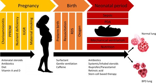 [P00-P96] ⅩⅥ. 출생전후기에 기원한 특정 병태(P00-P96)