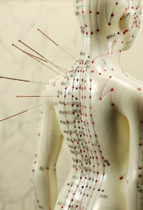 침, 약침, 추나요법