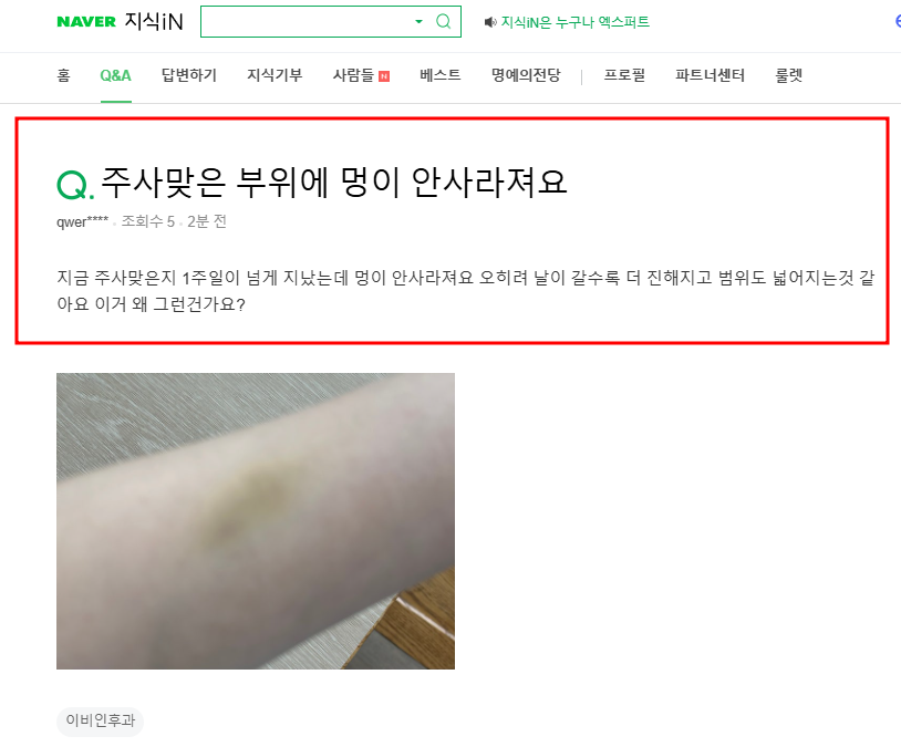 주사맞은 부위에 멍이 안사라져요