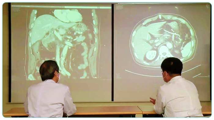 ebs-명의-담도암-수술-준비