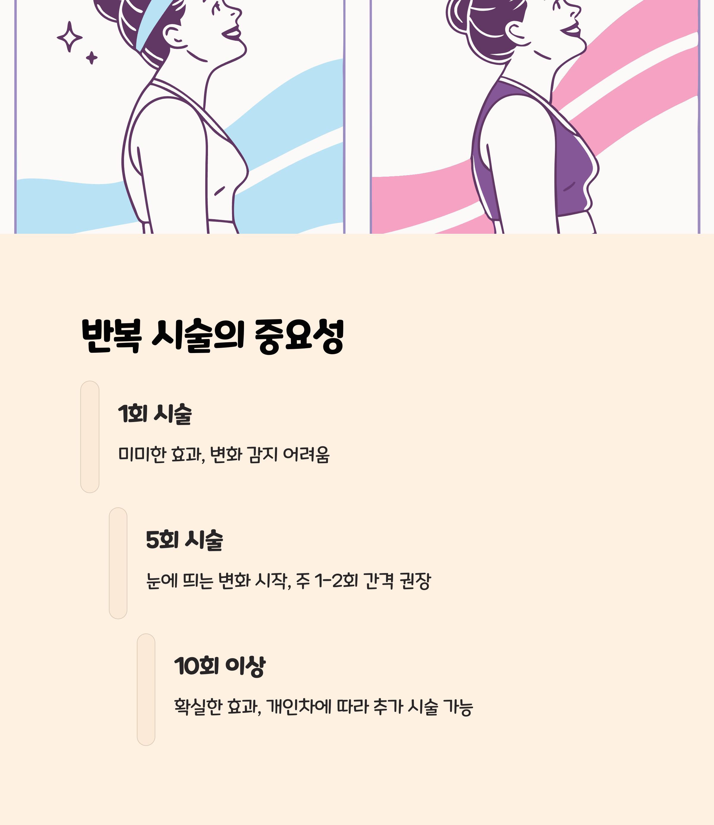 반복 시술이 필요한 이유: 단발성보다는 계획적 접근