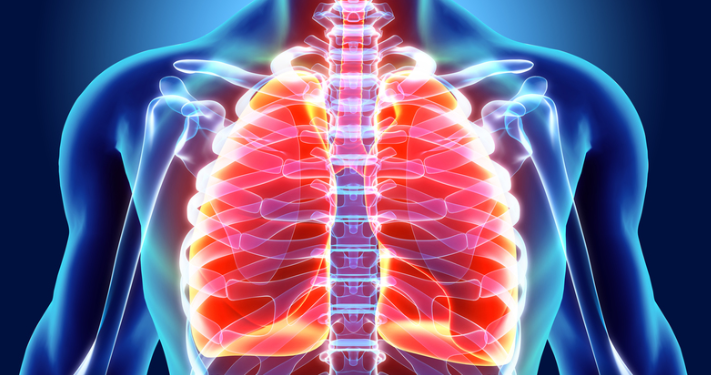 이코노미 클래스 증후군