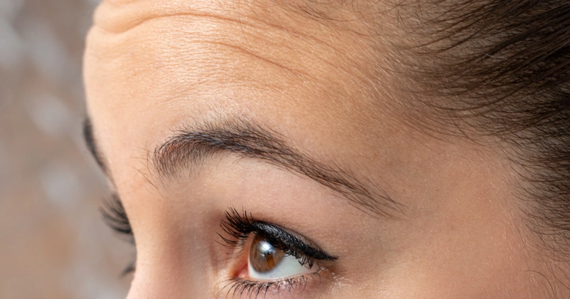 이마에 힘을주고 눈을 뜸